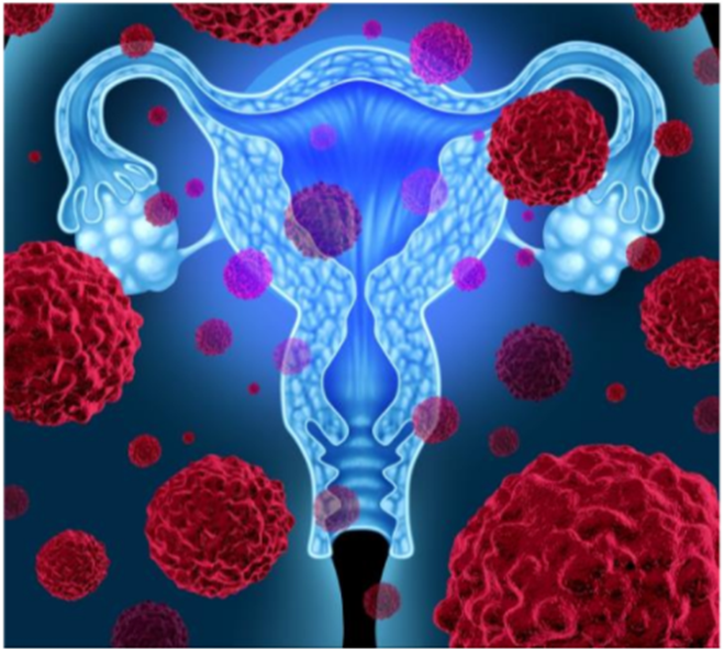 A imagem tem fundo azul, mostra um útero humano cercado de células vermelhas